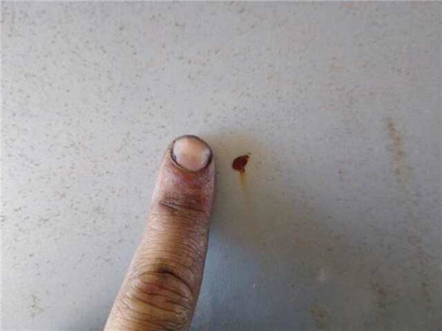 Foto 2ª: Capot Renault Clio 1.9 DTI ALIZE [1.9 LTR. - 59 KW DTI DIESEL] [f9q782]